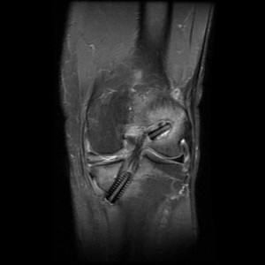 erdincmordumanaclintrafix